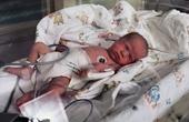 Немецкие врачи выходили 275-граммового новорожденного ребенка