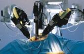 Российские хирурги удалили долю печени с помощью робота