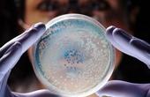 Конкурирующие между собой безопасные бактерии могут вызывать развитие болезней