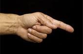 Особенности развития мужской руки способны раскрыть предрасположенность к раку простаты