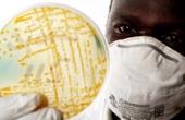 Штамм холеры, обнаруженный на Гаити, идентичен штамму, распространенному в Южной Азии 