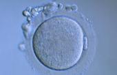 Донорство яйцеклеток: путь к счастливому материнству с рисками и побочными эффектами
