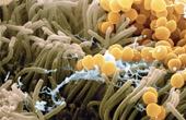 Исследование показало, как патогенные бактерии прячутся внутри клеток-хозяев
