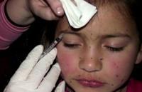 Американский косметолог вкалывает «Ботокс» своей 8-летней дочери