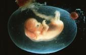 Содержащееся в пластмассах вещество бисфенол А обнаружено в печени эмбрионов