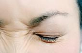 Регулярный прием аспирина может повысить риск возникновения проблем с глазами