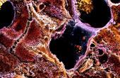 Вредоносные клетки могут участвовать в восстановлении печени