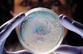 Резистентность к антибиотикам может задерживать рост бактерий