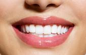 Отбеливание зубов: секреты голливудской улыбки