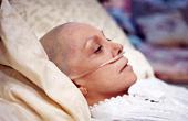 Рак: причины и лечение