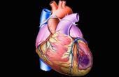 Установление искусственного желудочка сердца