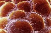 Стволовые клетки ускоряют течение рака