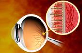 Стоит ли принимать глазные витамины?