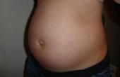 Инфекции мочевых путей во время беременности могут вызывать развитие аномалий сердца у детей