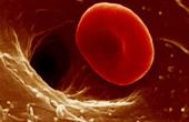 Лечение низкого уровня гемоглобина в крови