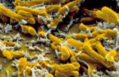Комбинация тиофена и изониазида полностью уничтожает туберкулез