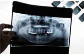 Рентгенологическое обследование в стоматологии