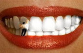 Способы профессионального отбеливания зубов