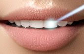 Три пути к совершенной улыбке со стоматологией «Гелиосмедикал»