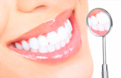 Как происходит отбеливание зубов в стоматологии