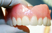 Протезирование зубов при пародонтозе – особенности и этапы зубной процедуры