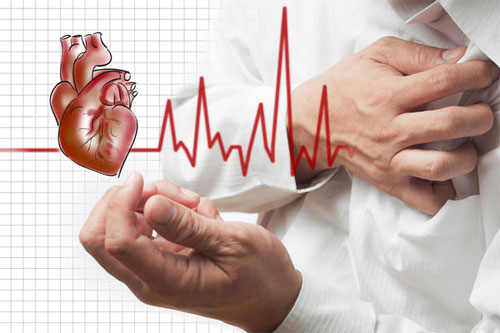 Инфаркт миокарда: признаки и профилактика