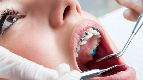 Ортодонт в стоматологическом направлении