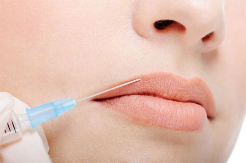 Увеличение губ. Цена и описание процедуры