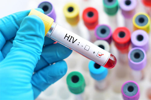 Показания к сдаче анализа на ВИЧ