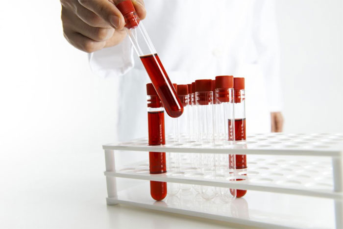 Анализ крови на ФСГ: значение и правила подготовки