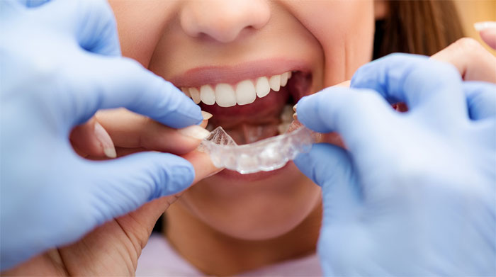 Профилактика и лечение заболеваний зубов