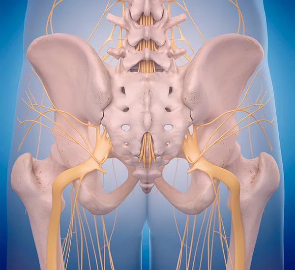 Как облегчить боль в седалищном нерве?