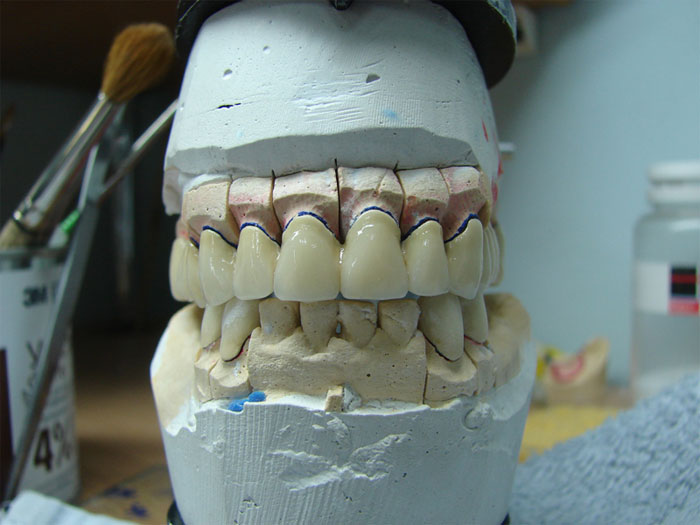 Лечение, протезирование и имплантация зубов