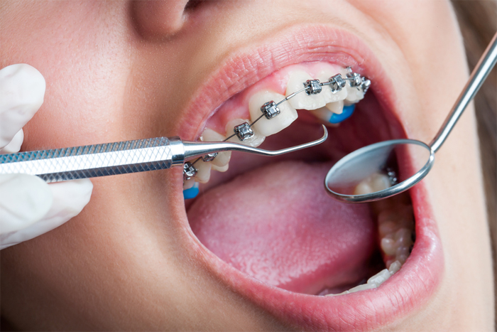 Чем занимается ортодонт