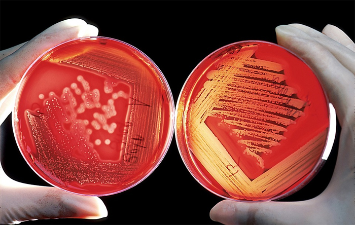 Новое оружие против устойчивых к антибиотикам бактерий