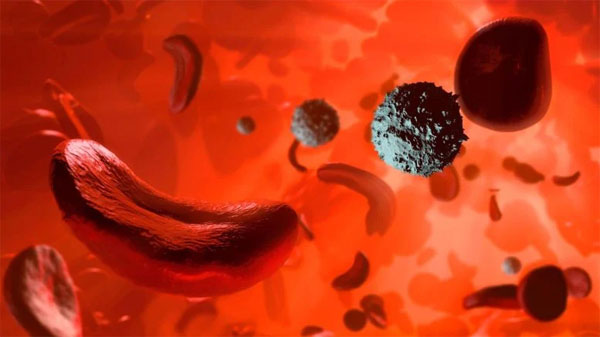 Лечение серповидно-клеточной анемии