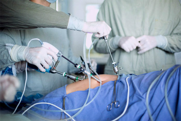 Абдоминальная хирургия: методы, подготовка, восстановление